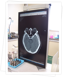 CT・MRIの写真